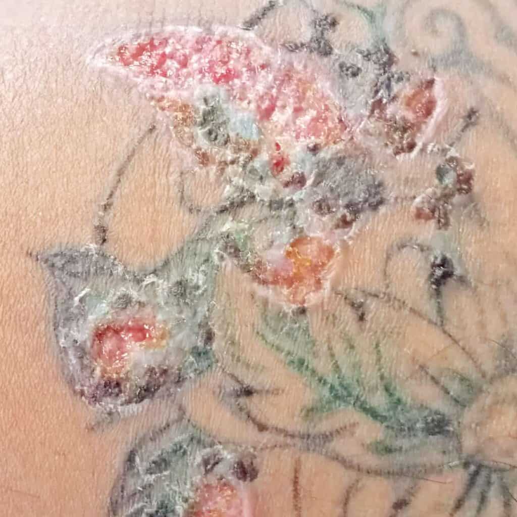 A person with a fresh tattoo stays away from the swimming pool.