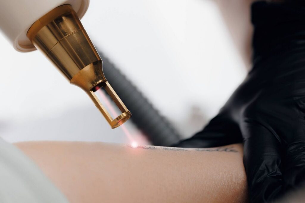 Nghệ sĩ vẽ thiết kế cover-up lên hình xăm cũ đã mờ bằng laser
