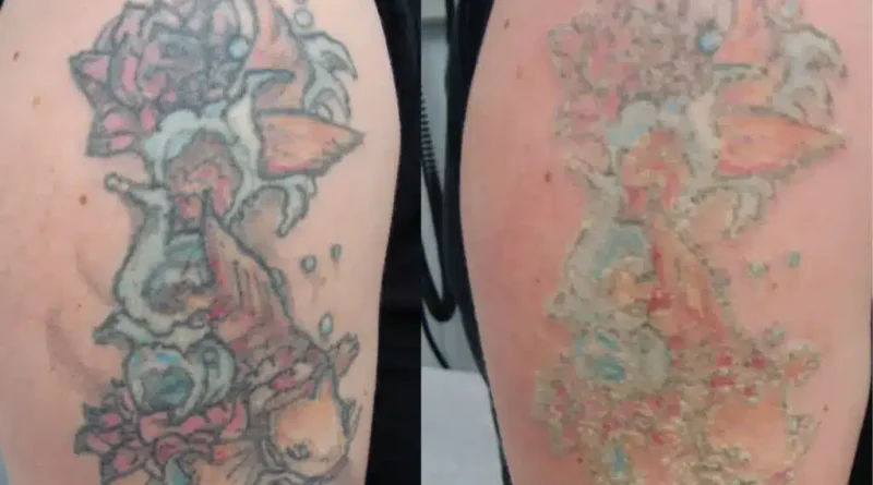 An artist inspects a healed tattoo under a magnifying lamp, checking line quality and color.