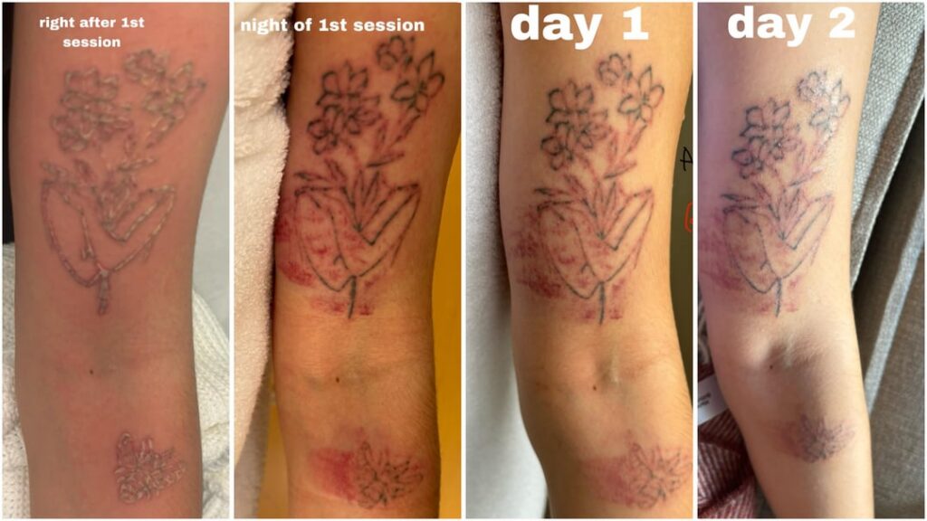 Applying aftercare ointment to a healing fine line tattoo
